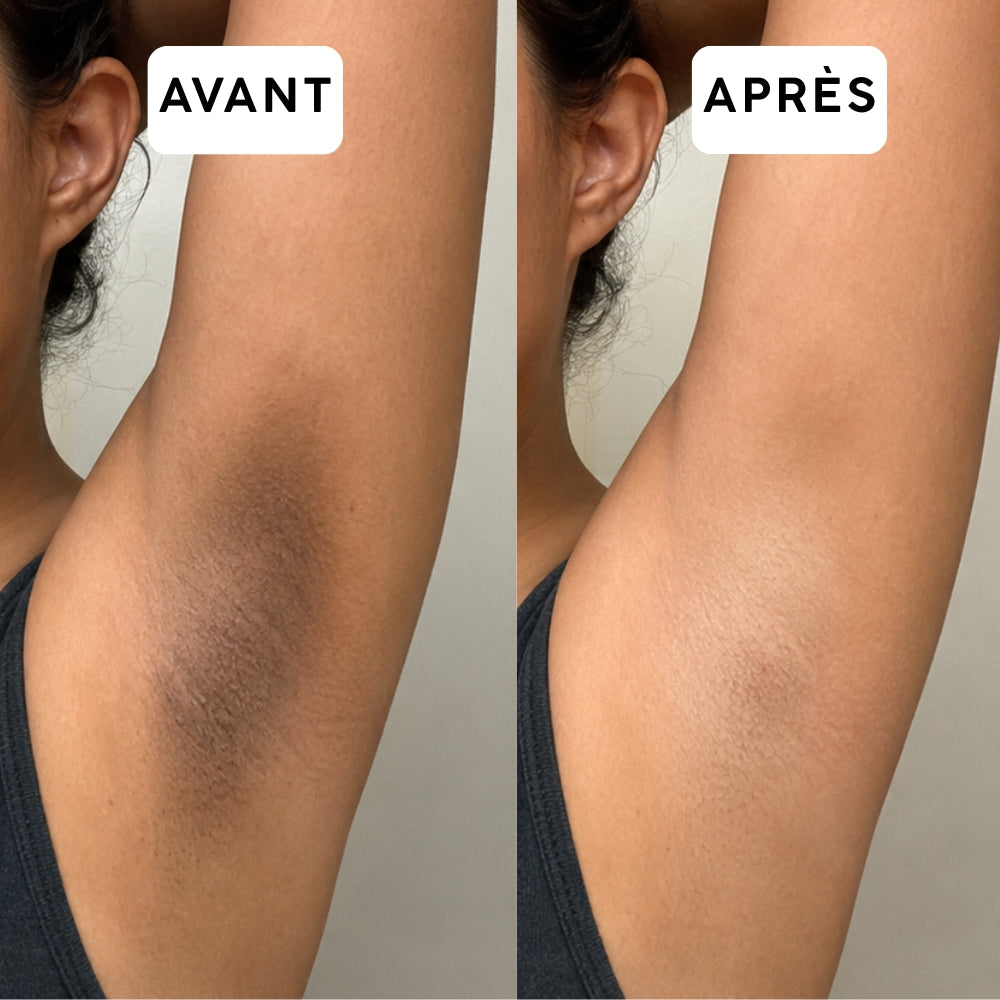 Retinal Shot 0,1 % – Soin de nuit 15 ml